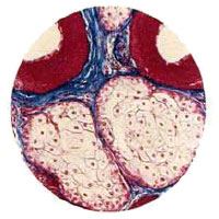 Ткань легких под микроскопом